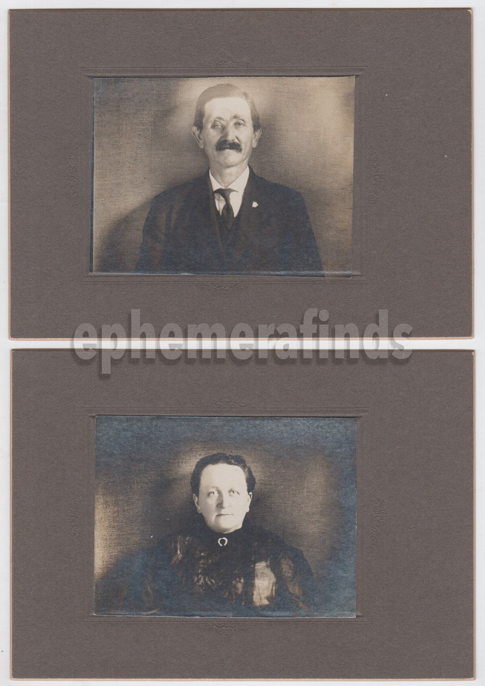 Wife and Husband with Facial Deformity Antique Photos on Board
