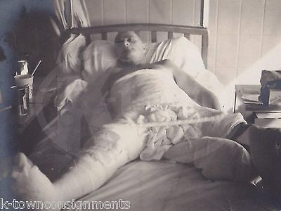 BOB BLAKE BODY CAST CONEY ISLAND HOSPITAL BED VINTAGE MEDICAL POLAROID PHOTO - K-townConsignments