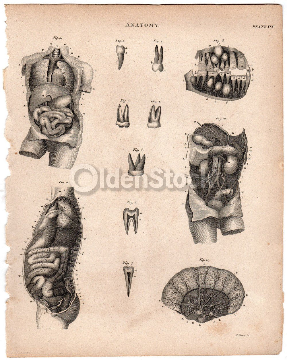 Human Anatomy Kidneys Colon Internal Medicine Antique Graphic Engraving Print Book Plate