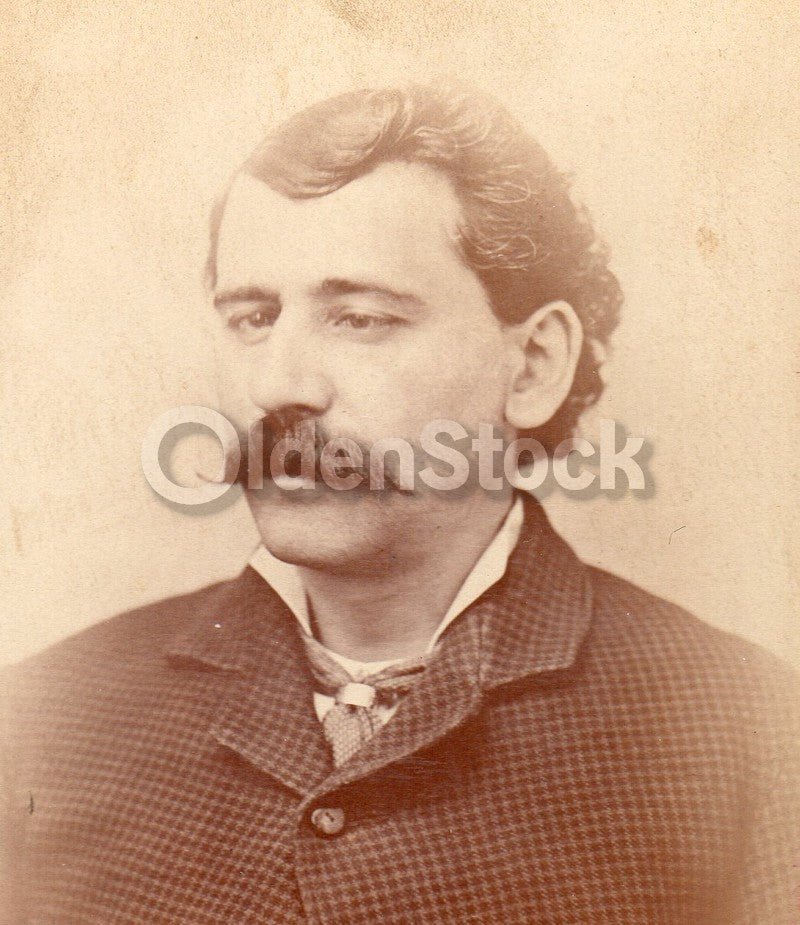 Cross Eyed Man Medical Condition London Coney Island Antique Cabinet Card Photo