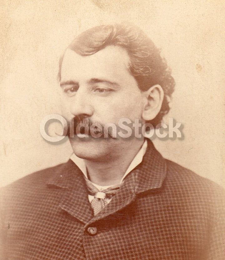 Cross Eyed Man Medical Condition London Coney Island Antique Cabinet Card Photo